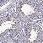 LRRC27 Antibody in Immunohistochemistry (Paraffin) (IHC (P))