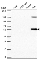 LRRC27 Antibody in Western Blot (WB)