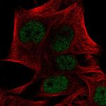 PRDM4 Polyclonal Antibody