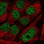 GMEB2 Polyclonal Antibody