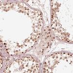 GMEB2 Antibody in Immunohistochemistry (Paraffin) (IHC (P))