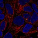 GPR98 Polyclonal Antibody