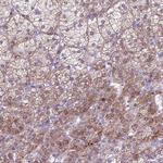GPR98 Antibody in Immunohistochemistry (Paraffin) (IHC (P))