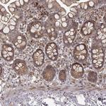 SLC12A9 Polyclonal Antibody