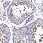 RDM1 Antibody in Immunohistochemistry (Paraffin) (IHC (P))