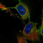 MARCKS Polyclonal Antibody