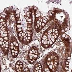 MARCKS Antibody in Immunohistochemistry (Paraffin) (IHC (P))