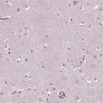 SLAMF8 Polyclonal Antibody