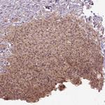 PARP3 Polyclonal Antibody