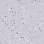 MIP-3 beta Polyclonal Antibody