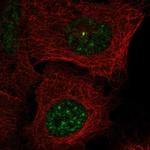 BCAS2 Polyclonal Antibody