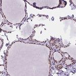 BCAS2 Antibody in Immunohistochemistry (Paraffin) (IHC (P))