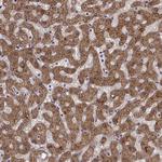 ADH6 Antibody in Immunohistochemistry (Paraffin) (IHC (P))
