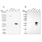 ADH6 Antibody in Western Blot (WB)