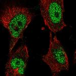 POLK Polyclonal Antibody