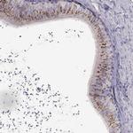 DEFB136 Polyclonal Antibody