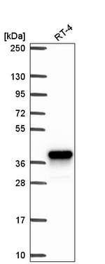 AKR1C1 Antibody in Western Blot (WB)