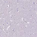 AIM Antibody in Immunohistochemistry (Paraffin) (IHC (P))