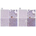 AIM Polyclonal Antibody