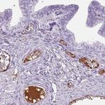 AIM Antibody in Immunohistochemistry (Paraffin) (IHC (P))