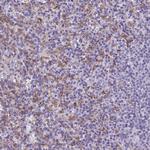 AIM Antibody in Immunohistochemistry (Paraffin) (IHC (P))