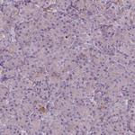 SOX17 Polyclonal Antibody