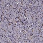 FTO Polyclonal Antibody