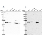 PHKG2 Antibody in Western Blot (WB)