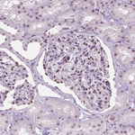PIAS2 Antibody in Immunohistochemistry (Paraffin) (IHC (P))