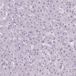 PIAS2 Antibody in Immunohistochemistry (Paraffin) (IHC (P))