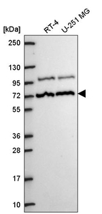MED25 Antibody in Western Blot (WB)
