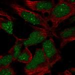 RP11-302B13.5 Antibody in Immunocytochemistry (ICC/IF)