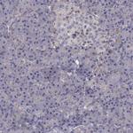 ITGB1 Antibody in Immunohistochemistry (Paraffin) (IHC (P))