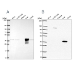 ADH6 Antibody in Western Blot (WB)