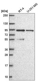 PIK3R2 Antibody in Western Blot (WB)