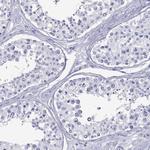 CD150 Antibody in Immunohistochemistry (Paraffin) (IHC (P))