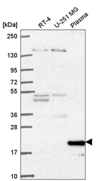 Cyclin C Antibody in Western Blot (WB)