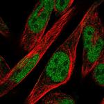 ZNF594 Antibody in Immunocytochemistry (ICC/IF)