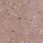 MARCKS Polyclonal Antibody