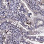 CCK Polyclonal Antibody