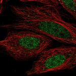 CCDC36 Polyclonal Antibody