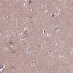 Tau Antibody in Immunohistochemistry (Paraffin) (IHC (P))