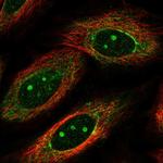 MKP-1 Polyclonal Antibody