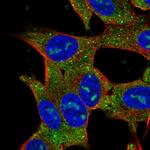 RP11-195F19.5 Polyclonal Antibody