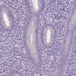 RP11-195F19.5 Antibody in Immunohistochemistry (Paraffin) (IHC (P))