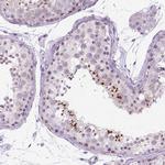 RP11-195F19.5 Antibody in Immunohistochemistry (Paraffin) (IHC (P))