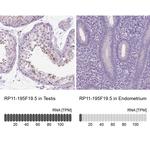 RP11-195F19.5 Antibody