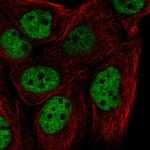 hnRNP F Polyclonal Antibody