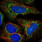 UCP4 Polyclonal Antibody