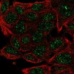 Carabin Polyclonal Antibody